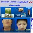 192-infection-control